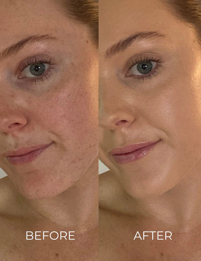 Inika Organic Serum Foundation Before & After. Feel the difference now at One Fine Secret.